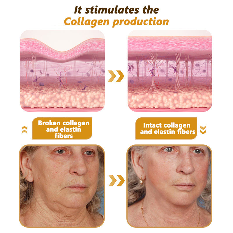 ๐๐๐พ๐ญ๐๐ฅ๐ข๐ฌ๐ฒ๐ฌยฎ ๐กe๐พ V๐พnom & PDRN Anti-Aging Firming Cream | Lifts, Tightens & Smooths Skin | Reduces Wrinkles & Fine Lines | Restores Youthful Elasticity | Powerful Bee Venom Formula ๐ฅ๐ฅ๐ฅ