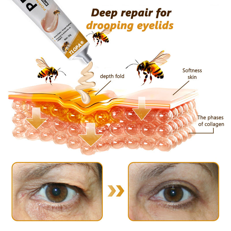 ๐ฉโโ๏ธ๐๐พ๐ญ๐๐ฅ๐ข๐ฌ๐ฒ๐ฌยฎ ๐กe๐พ V๐พnom & PDRN Anti-Aging Firming Cream | Lifts, Tightens & Smooths Skin | Reduces Wrinkles & Fine Lines | Restores Youthful Elasticity | Powerful Bee Venom Formula ๐ฅ๐ฅ๐ฅ