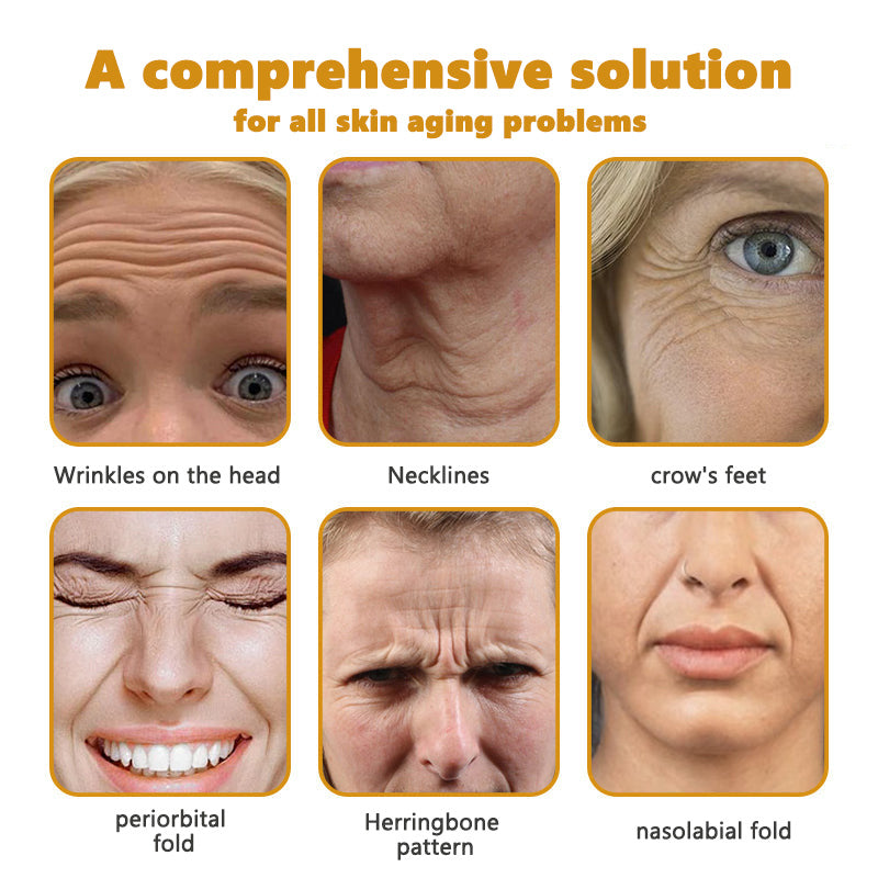 30% OFF🎁🎁𝐕𝒾𝐭𝐚𝐥𝐢𝐬𝐲𝐬® 𝖡e𝖾 V𝖾nom & PDRN Anti-Aging Firming Cream | Lifts, Tightens & Smooths Skin | Reduces Wrinkles & Fine Lines | Restores Youthful Elasticity | Powerful Bee Venom Formula 🔥🔥
