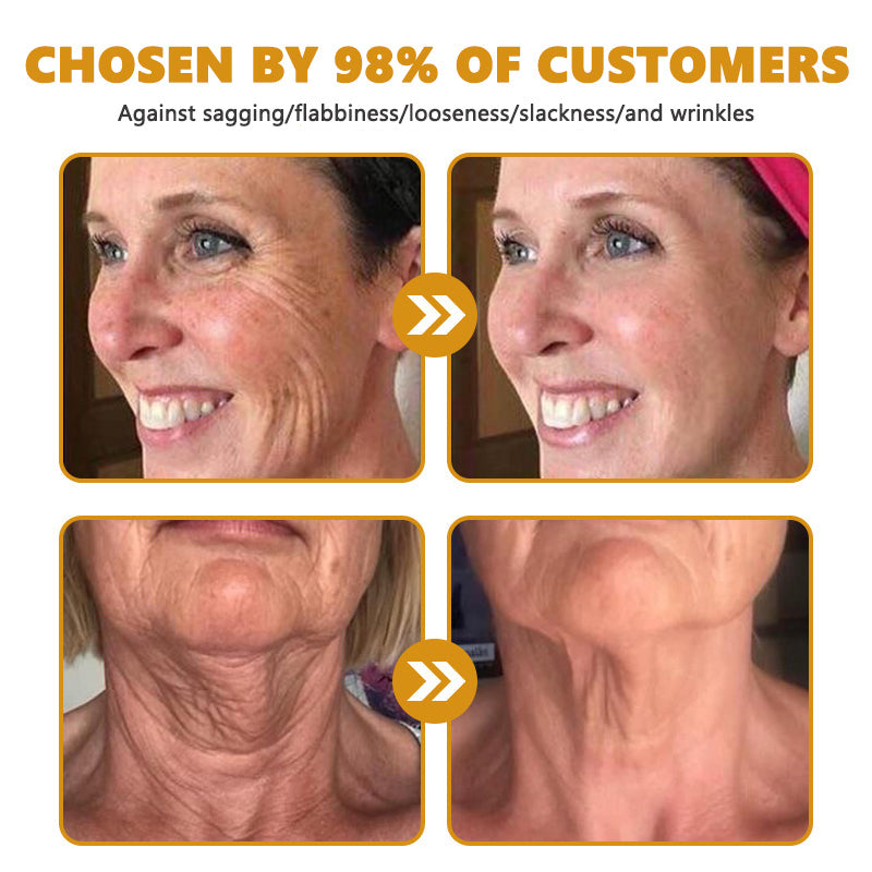 30% OFF🎁🎁𝐕𝒾𝐭𝐚𝐥𝐢𝐬𝐲𝐬® 𝖡e𝖾 V𝖾nom & PDRN Anti-Aging Firming Cream | Lifts, Tightens & Smooths Skin | Reduces Wrinkles & Fine Lines | Restores Youthful Elasticity | Powerful Bee Venom Formula 🔥🔥