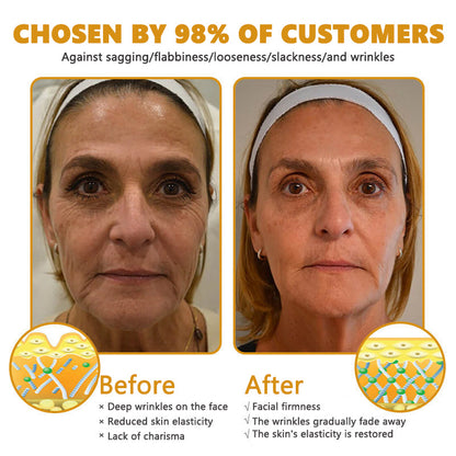 30% OFF🎁🎁𝐕𝒾𝐭𝐚𝐥𝐢𝐬𝐲𝐬® 𝖡e𝖾 V𝖾nom & PDRN Anti-Aging Firming Cream | Lifts, Tightens & Smooths Skin | Reduces Wrinkles & Fine Lines | Restores Youthful Elasticity | Powerful Bee Venom Formula 🔥🔥