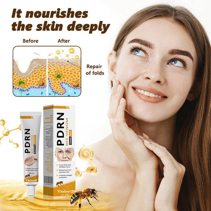 🌏𝐕𝒾𝐭𝐚𝐥𝐢𝐬𝐲𝐬® 𝖡e𝖾 V𝖾nom & PDRN Anti-Aging Firming Cream | Lifts, Tightens & Smooths Skin | Reduces Wrinkles & Fine Lines | Restores Youthful Elasticity | Powerful Bee Venom Formula 🔥🔥🔥