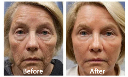 30% OFF🎁🎁𝐕𝒾𝐭𝐚𝐥𝐢𝐬𝐲𝐬® 𝖡e𝖾 V𝖾nom & PDRN Anti-Aging Firming Cream | Lifts, Tightens & Smooths Skin | Reduces Wrinkles & Fine Lines | Restores Youthful Elasticity | Powerful Bee Venom Formula 🔥🔥
