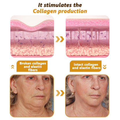 30% OFF🎁🎁𝐕𝒾𝐭𝐚𝐥𝐢𝐬𝐲𝐬® 𝖡e𝖾 V𝖾nom & PDRN Anti-Aging Firming Cream | Lifts, Tightens & Smooths Skin | Reduces Wrinkles & Fine Lines | Restores Youthful Elasticity | Powerful Bee Venom Formula 🔥🔥