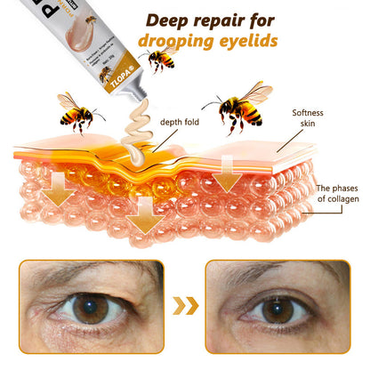 👑𝐕𝒾𝐭𝐚𝐥𝐢𝐬𝐲𝐬® 𝖡e𝖾 V𝖾nom & PDRN Anti-Aging Firming Cream | Lifts, Tightens & Smooths Skin | Reduces Wrinkles & Fine Lines | Restores Youthful Elasticity | Powerful Bee Venom Formula 🔥🔥🔥