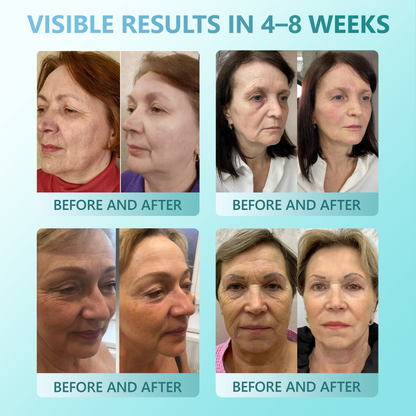 30% OFF🎁🎁Recommended by Australian Dermatologists 💕 𝐕𝒾𝐭𝐚𝐥𝐢𝐬𝐲𝐬® 𝐏𝐃𝐑𝐍 Anti‑Age & Firming Serum Stick ✨ (🔥FINAL DAY 70% OFF🔥)🔥
