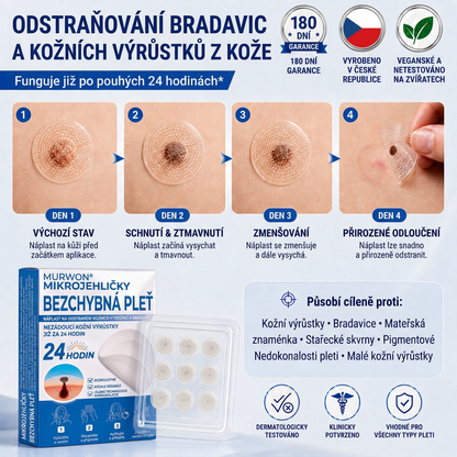 👩‍⚕️💯 𝑶𝒇𝒇𝒊𝒛𝒊𝒆𝒍𝒍𝒆𝒓 𝑺𝒕𝒐𝒓𝒆 | Vitalisys® 🌿 𝑴𝒊𝒌𝒓𝒐𝒏𝒂𝒅𝒆𝒍𝒏 𝑴𝒂𝒌𝒆𝒍𝒍𝒐𝒔𝒆 𝑯𝒂𝒖𝒕 𝑯𝒂𝒖𝒕 𝑾𝒂𝒓𝒛𝒆 𝑬𝒏𝒕𝒇𝒆𝒓𝒏𝒖𝒏𝒈 𝑷𝒇𝒍𝒂𝒔𝒕𝒆𝒓 (𝐹ü𝑟 𝐻𝑎𝑢𝑡𝑎𝑛ℎä𝑛𝑔𝑠𝑒𝑙, 𝑘𝑙𝑒𝑖𝑛𝑒 𝐻𝑎𝑢𝑡𝑤𝑢𝑐ℎ𝑒𝑟𝑢𝑛𝑔𝑒𝑛, 𝑊𝑎𝑟𝑧𝑒𝑛, 𝑀𝑢𝑡𝑡𝑒𝑟𝑚𝑎𝑙𝑒, 𝐴𝑙𝑡𝑒𝑟𝑠𝑓𝑙𝑒𝑐𝑘𝑒𝑛 𝑢𝑛𝑑 𝑃𝑖𝑔𝑚𝑒𝑛𝑡𝑠𝑡ö𝑟𝑢𝑛𝑔𝑒𝑛.)