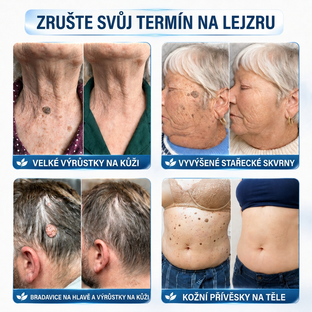 👩‍⚕️💯 𝑶𝒇𝒇𝒊𝒛𝒊𝒆𝒍𝒍𝒆𝒓 𝑺𝒕𝒐𝒓𝒆 | Vitalisys® 🌿 𝑴𝒊𝒌𝒓𝒐𝒏𝒂𝒅𝒆𝒍𝒏 𝑴𝒂𝒌𝒆𝒍𝒍𝒐𝒔𝒆 𝑯𝒂𝒖𝒕 𝑯𝒂𝒖𝒕 𝑾𝒂𝒓𝒛𝒆 𝑬𝒏𝒕𝒇𝒆𝒓𝒏𝒖𝒏𝒈 𝑷𝒇𝒍𝒂𝒔𝒕𝒆𝒓 (𝐹ü𝑟 𝐻𝑎𝑢𝑡𝑎𝑛ℎä𝑛𝑔𝑠𝑒𝑙, 𝑘𝑙𝑒𝑖𝑛𝑒 𝐻𝑎𝑢𝑡𝑤𝑢𝑐ℎ𝑒𝑟𝑢𝑛𝑔𝑒𝑛, 𝑊𝑎𝑟𝑧𝑒𝑛, 𝑀𝑢𝑡𝑡𝑒𝑟𝑚𝑎𝑙𝑒, 𝐴𝑙𝑡𝑒𝑟𝑠𝑓𝑙𝑒𝑐𝑘𝑒𝑛 𝑢𝑛𝑑 𝑃𝑖𝑔𝑚𝑒𝑛𝑡𝑠𝑡ö𝑟𝑢𝑛𝑔𝑒𝑛.)