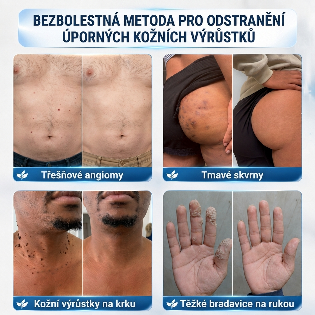 👩‍⚕️💯 𝑶𝒇𝒇𝒊𝒛𝒊𝒆𝒍𝒍𝒆𝒓 𝑺𝒕𝒐𝒓𝒆 | Vitalisys® 🌿 𝑴𝒊𝒌𝒓𝒐𝒏𝒂𝒅𝒆𝒍𝒏 𝑴𝒂𝒌𝒆𝒍𝒍𝒐𝒔𝒆 𝑯𝒂𝒖𝒕 𝑯𝒂𝒖𝒕 𝑾𝒂𝒓𝒛𝒆 𝑬𝒏𝒕𝒇𝒆𝒓𝒏𝒖𝒏𝒈 𝑷𝒇𝒍𝒂𝒔𝒕𝒆𝒓 (𝐹ü𝑟 𝐻𝑎𝑢𝑡𝑎𝑛ℎä𝑛𝑔𝑠𝑒𝑙, 𝑘𝑙𝑒𝑖𝑛𝑒 𝐻𝑎𝑢𝑡𝑤𝑢𝑐ℎ𝑒𝑟𝑢𝑛𝑔𝑒𝑛, 𝑊𝑎𝑟𝑧𝑒𝑛, 𝑀𝑢𝑡𝑡𝑒𝑟𝑚𝑎𝑙𝑒, 𝐴𝑙𝑡𝑒𝑟𝑠𝑓𝑙𝑒𝑐𝑘𝑒𝑛 𝑢𝑛𝑑 𝑃𝑖𝑔𝑚𝑒𝑛𝑡𝑠𝑡ö𝑟𝑢𝑛𝑔𝑒𝑛.)