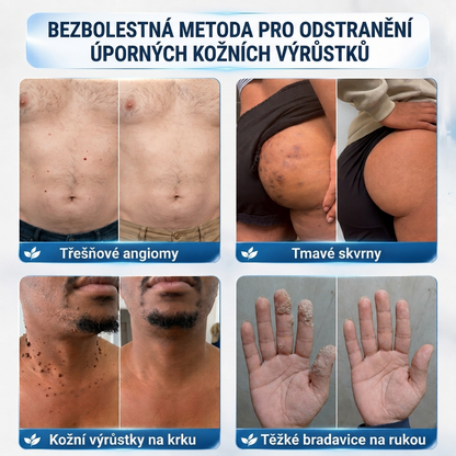 👩‍⚕️💯 𝑶𝒇𝒇𝒊𝒛𝒊𝒆𝒍𝒍𝒆𝒓 𝑺𝒕𝒐𝒓𝒆 | Vitalisys® 🌿 𝑴𝒊𝒌𝒓𝒐𝒏𝒂𝒅𝒆𝒍𝒏 𝑴𝒂𝒌𝒆𝒍𝒍𝒐𝒔𝒆 𝑯𝒂𝒖𝒕 𝑯𝒂𝒖𝒕 𝑾𝒂𝒓𝒛𝒆 𝑬𝒏𝒕𝒇𝒆𝒓𝒏𝒖𝒏𝒈 𝑷𝒇𝒍𝒂𝒔𝒕𝒆𝒓 (𝐹ü𝑟 𝐻𝑎𝑢𝑡𝑎𝑛ℎä𝑛𝑔𝑠𝑒𝑙, 𝑘𝑙𝑒𝑖𝑛𝑒 𝐻𝑎𝑢𝑡𝑤𝑢𝑐ℎ𝑒𝑟𝑢𝑛𝑔𝑒𝑛, 𝑊𝑎𝑟𝑧𝑒𝑛, 𝑀𝑢𝑡𝑡𝑒𝑟𝑚𝑎𝑙𝑒, 𝐴𝑙𝑡𝑒𝑟𝑠𝑓𝑙𝑒𝑐𝑘𝑒𝑛 𝑢𝑛𝑑 𝑃𝑖𝑔𝑚𝑒𝑛𝑡𝑠𝑡ö𝑟𝑢𝑛𝑔𝑒𝑛.)