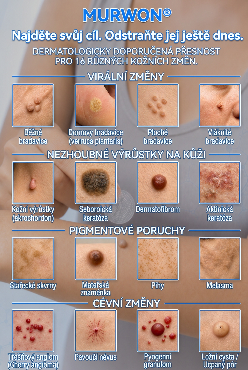 👩‍⚕️💯 𝑶𝒇𝒇𝒊𝒛𝒊𝒆𝒍𝒍𝒆𝒓 𝑺𝒕𝒐𝒓𝒆 | Vitalisys® 🌿 𝑴𝒊𝒌𝒓𝒐𝒏𝒂𝒅𝒆𝒍𝒏 𝑴𝒂𝒌𝒆𝒍𝒍𝒐𝒔𝒆 𝑯𝒂𝒖𝒕 𝑯𝒂𝒖𝒕 𝑾𝒂𝒓𝒛𝒆 𝑬𝒏𝒕𝒇𝒆𝒓𝒏𝒖𝒏𝒈 𝑷𝒇𝒍𝒂𝒔𝒕𝒆𝒓 (𝐹ü𝑟 𝐻𝑎𝑢𝑡𝑎𝑛ℎä𝑛𝑔𝑠𝑒𝑙, 𝑘𝑙𝑒𝑖𝑛𝑒 𝐻𝑎𝑢𝑡𝑤𝑢𝑐ℎ𝑒𝑟𝑢𝑛𝑔𝑒𝑛, 𝑊𝑎𝑟𝑧𝑒𝑛, 𝑀𝑢𝑡𝑡𝑒𝑟𝑚𝑎𝑙𝑒, 𝐴𝑙𝑡𝑒𝑟𝑠𝑓𝑙𝑒𝑐𝑘𝑒𝑛 𝑢𝑛𝑑 𝑃𝑖𝑔𝑚𝑒𝑛𝑡𝑠𝑡ö𝑟𝑢𝑛𝑔𝑒𝑛.)