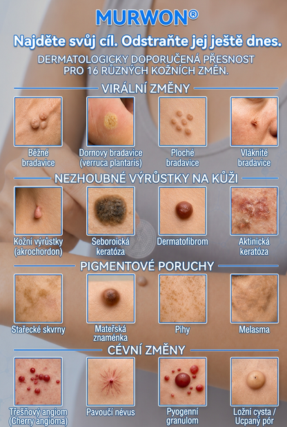 👩‍⚕️💯 𝑶𝒇𝒇𝒊𝒛𝒊𝒆𝒍𝒍𝒆𝒓 𝑺𝒕𝒐𝒓𝒆 | Vitalisys® 🌿 𝑴𝒊𝒌𝒓𝒐𝒏𝒂𝒅𝒆𝒍𝒏 𝑴𝒂𝒌𝒆𝒍𝒍𝒐𝒔𝒆 𝑯𝒂𝒖𝒕 𝑯𝒂𝒖𝒕 𝑾𝒂𝒓𝒛𝒆 𝑬𝒏𝒕𝒇𝒆𝒓𝒏𝒖𝒏𝒈 𝑷𝒇𝒍𝒂𝒔𝒕𝒆𝒓 (𝐹ü𝑟 𝐻𝑎𝑢𝑡𝑎𝑛ℎä𝑛𝑔𝑠𝑒𝑙, 𝑘𝑙𝑒𝑖𝑛𝑒 𝐻𝑎𝑢𝑡𝑤𝑢𝑐ℎ𝑒𝑟𝑢𝑛𝑔𝑒𝑛, 𝑊𝑎𝑟𝑧𝑒𝑛, 𝑀𝑢𝑡𝑡𝑒𝑟𝑚𝑎𝑙𝑒, 𝐴𝑙𝑡𝑒𝑟𝑠𝑓𝑙𝑒𝑐𝑘𝑒𝑛 𝑢𝑛𝑑 𝑃𝑖𝑔𝑚𝑒𝑛𝑡𝑠𝑡ö𝑟𝑢𝑛𝑔𝑒𝑛.)