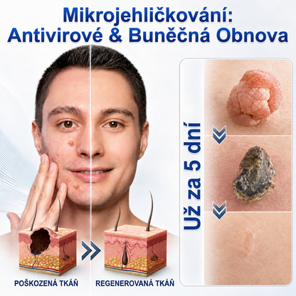 👩‍⚕️💯 𝑶𝒇𝒇𝒊𝒛𝒊𝒆𝒍𝒍𝒆𝒓 𝑺𝒕𝒐𝒓𝒆 | Vitalisys® 🌿 𝑴𝒊𝒌𝒓𝒐𝒏𝒂𝒅𝒆𝒍𝒏 𝑴𝒂𝒌𝒆𝒍𝒍𝒐𝒔𝒆 𝑯𝒂𝒖𝒕 𝑯𝒂𝒖𝒕 𝑾𝒂𝒓𝒛𝒆 𝑬𝒏𝒕𝒇𝒆𝒓𝒏𝒖𝒏𝒈 𝑷𝒇𝒍𝒂𝒔𝒕𝒆𝒓 (𝐹ü𝑟 𝐻𝑎𝑢𝑡𝑎𝑛ℎä𝑛𝑔𝑠𝑒𝑙, 𝑘𝑙𝑒𝑖𝑛𝑒 𝐻𝑎𝑢𝑡𝑤𝑢𝑐ℎ𝑒𝑟𝑢𝑛𝑔𝑒𝑛, 𝑊𝑎𝑟𝑧𝑒𝑛, 𝑀𝑢𝑡𝑡𝑒𝑟𝑚𝑎𝑙𝑒, 𝐴𝑙𝑡𝑒𝑟𝑠𝑓𝑙𝑒𝑐𝑘𝑒𝑛 𝑢𝑛𝑑 𝑃𝑖𝑔𝑚𝑒𝑛𝑡𝑠𝑡ö𝑟𝑢𝑛𝑔𝑒𝑛.)